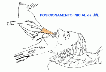 Mscara Larngea